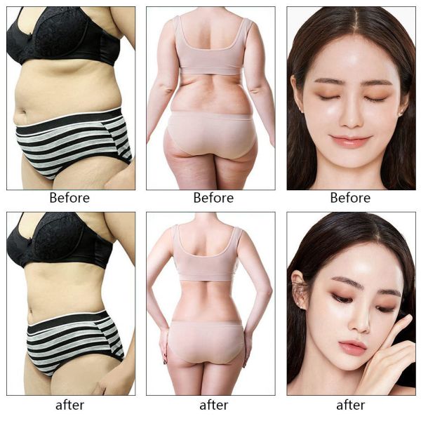 9 In 1 40K Cavitation Machine , RF Skin Tightening System For Beauty Salons