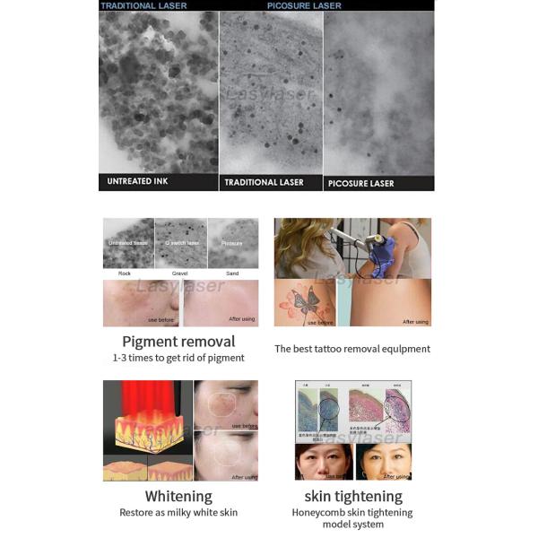 IPL SHR picolaser Tattoo Removal Machine , Salon Nd Yag Tattoo Removal Machine