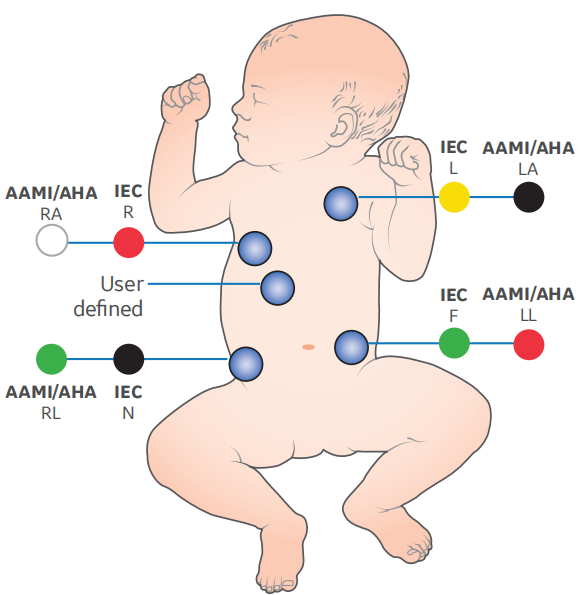 2106391-001 Сгруппированный набор отведений ЭКГ 5 Захват отведений AHA 74 см 29 дюймов 412681-001 414556-001