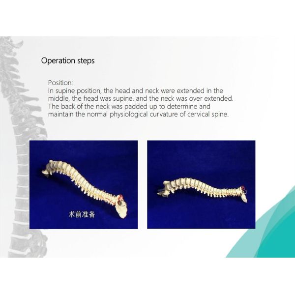 Spine Anterior Cervical Plate Titanium Cervical Plate Implant Orthopedic Surgery CE Certification