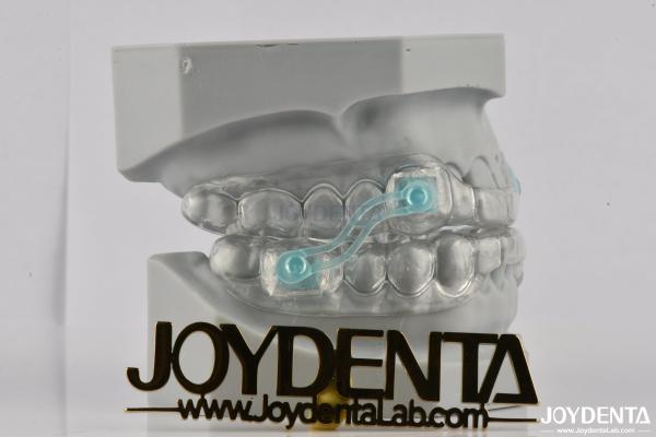 Custom Fitting Sleeping Aid Mouthpieces Dental Appliance To Stop Snoring
