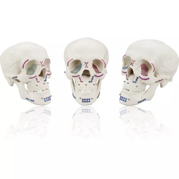 Maxillofacial Mini Locking Straight Plate 1.0mm Thickness Titanium