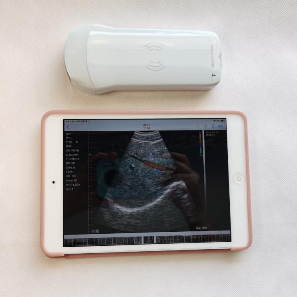 GYN High Quality Portable Veterinary Fast Delivery 3d Daignosis Medical Horse Ultrasound Machine For Cow
