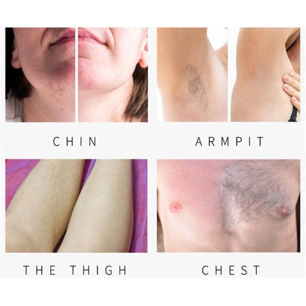 Устройство для удаления волос с помощью диодного лазера с длиной волны 3 808nm 755nm 1064nm