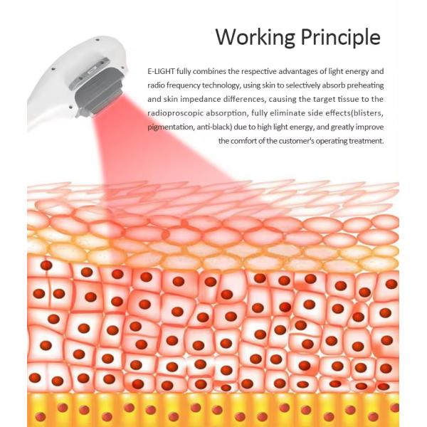 IPL OPT E-light Laser Hair Removal Permanent Machine 480nm 530nm 640nm