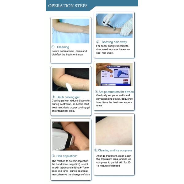 Best-selling 755nm 808nm 1064nm diode laser hair removal Laser machine for sale LF-646