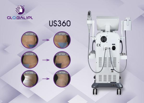 Body Shaper Fitness Hifu Beauty Machine Liposonix Fat Slimming Machine