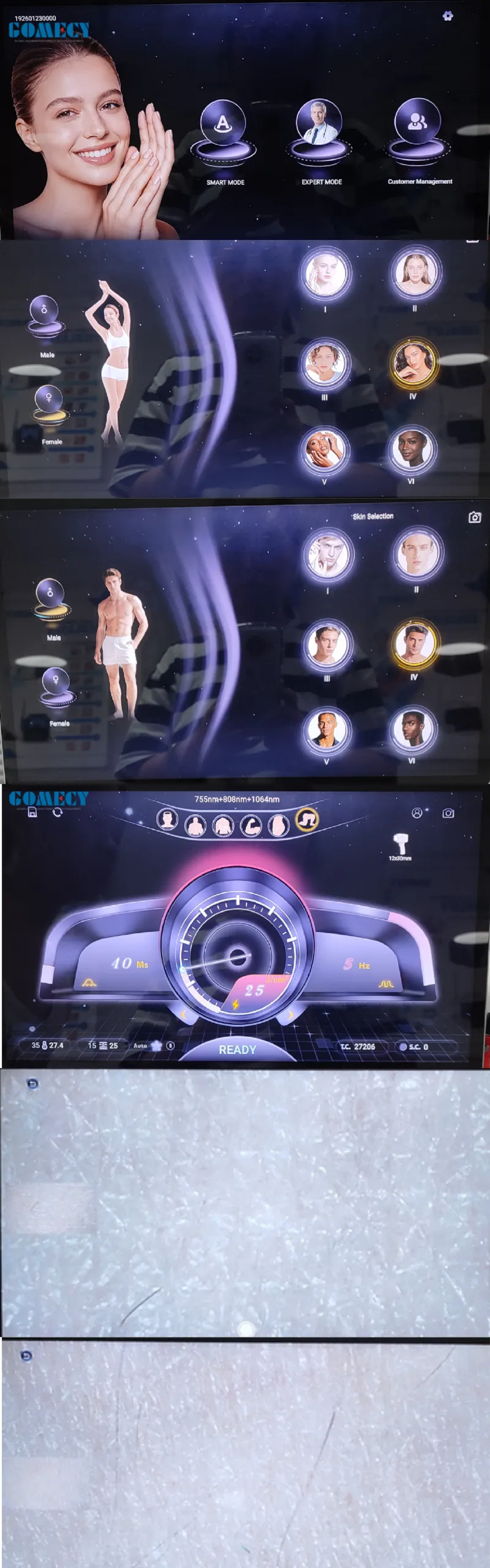 Gomecy High Power Diode Laser Hair Removal Machine 1600W 4 Wave Laser Equipment with Multi Cooling System for Salon Spa Clinic Use