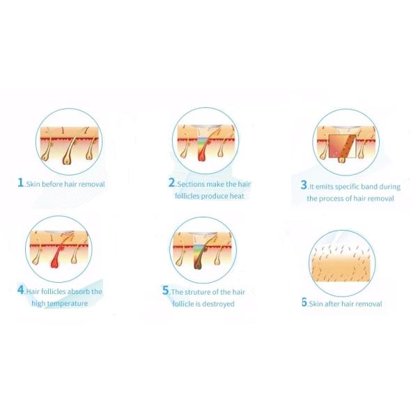 4HZ 808nm Clinic Diode Laser Hair Removal Machine