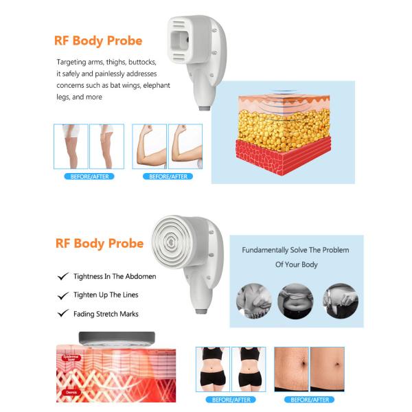 Máquina de microagujas de 300W RF 6 en 1 Máquina multifuncional para el cuidado de la piel