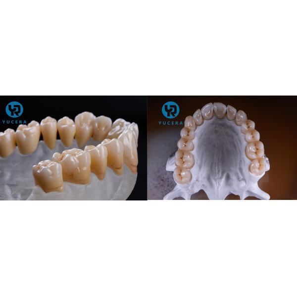 Зубоврачебный разнослоистый блок Zirconia 3D для зубоврачебного астетического восстановления