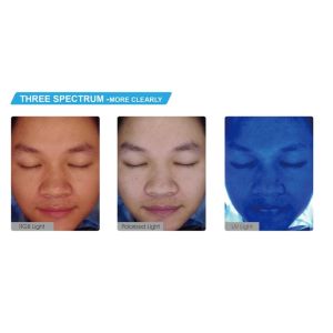Smart Skin Analyzer