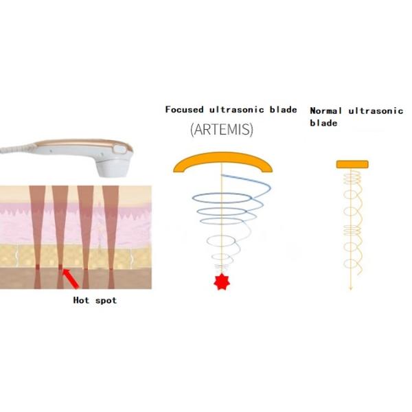 Home Use Focused HIFU Beauty Machine Skin Rejuvenation Wrinkle Removal HF119