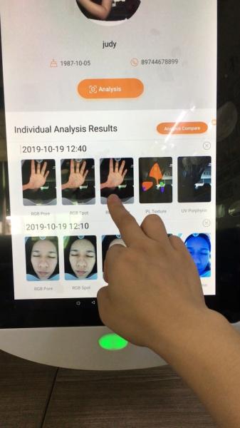 Korea Facial Analysis System Digital 64gb Storage For Doctor Clinic