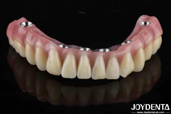 Translucent Ti-Base Acrylic Teeth Finish for Dental Laboratory Production
