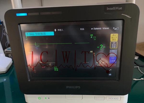 Réparation de chariot à moniteur patient de Philip MX400