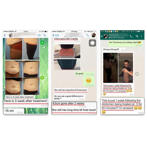 2018 latest Cryolipolysi Cool Shape machine Fat loss Cryolipolysis fat freezing machine Germany