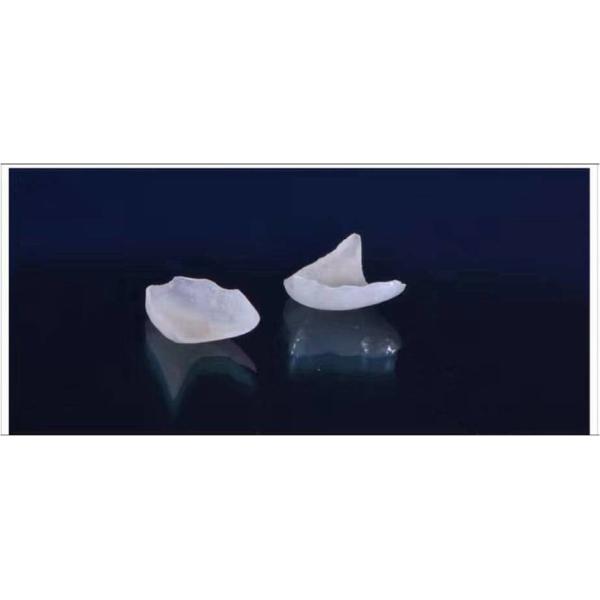 Natural Looking All Porcelain Veneers EMAX Dental Crown
