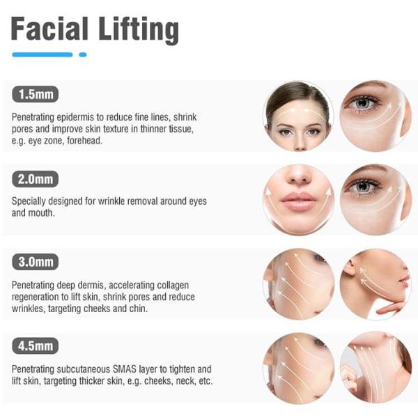 Лицевая ультра машина морщинки машины 7d красоты HiFu ультразвука патрона подъема анти-