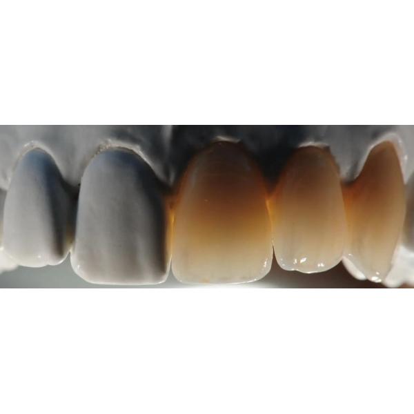 Pre Colored 3D Multilayer Zirconia Block Dental Zirconia Disc Open CAD CAM