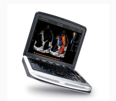 FDA Approved Laptop Ultrasound Machine Chison SonoBook 8 For Echocardiography