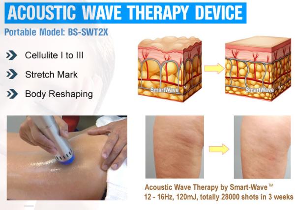 Body Beauty machine acoustic wave therapy machine for body slimming cellulite reduce