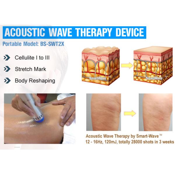 Применять обложку к затягивать машину 10 обработки целлюлита к непрерывно энергии 190мдж