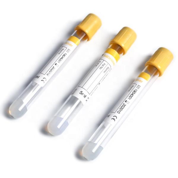 Blood Collection Tube 2ml-8ml Yellow Cap Gel Clot Activator Tube For Blood Collection