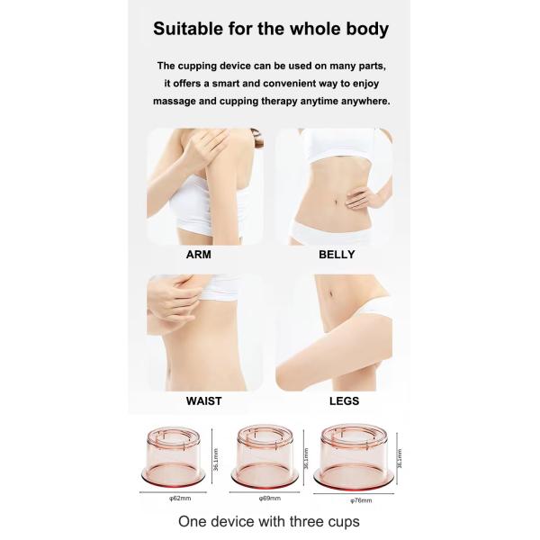 Fitdash Electric Cupping Therapy Set with Bian-Stone Moving Cupping Vacuum Cupping Set Device