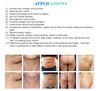 Most advanced CE approval beauty machine cavitation 5 in 1 ultrasonic cavitation radio frequency machine