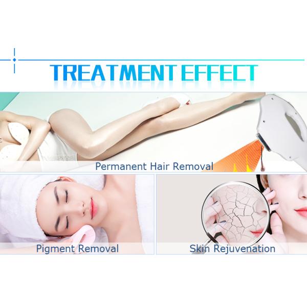 Beauty Salon Professional Laser Hair Removal Machine 60kg Weight CE Approved