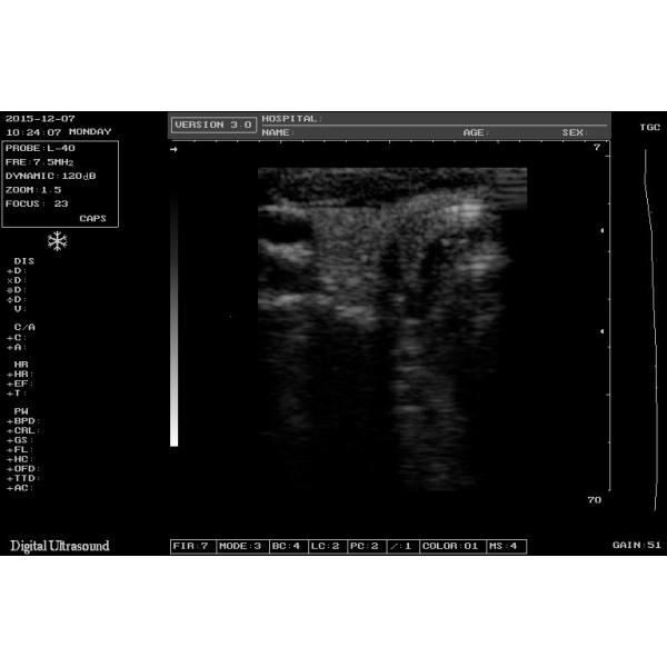 10.4 Inch B Ultrasound Diagnostic System 3.5MHZ Diagnostic Ultrasound Equipment