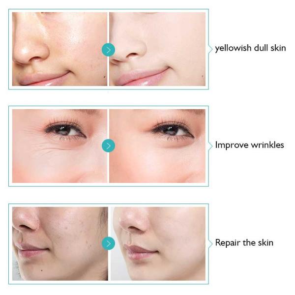 Сыворотка сыворотки удаления морщинки стволовой клетки Яблока противоокислительн для чувствительной кожи