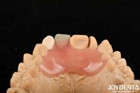 Alto sigilo buena elasticidad fin de dentadura flexible para diversos procesos de fabricación
