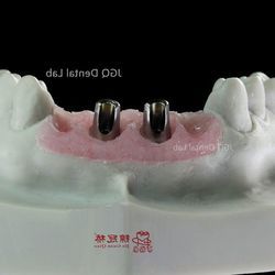 Custom Milled Dental Implant Abutments in Titanium Zirconia FDA CE Certification