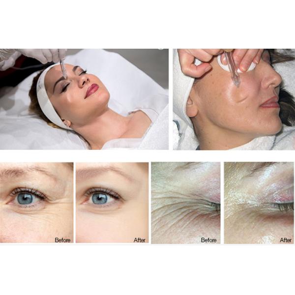 Тройной двигатель оружия брызг слезает чувство глубины проникания машины 0.3-2mm удобное