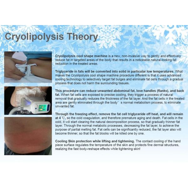 Cryo handles cool tech fat freezing weight loss vacuum machine