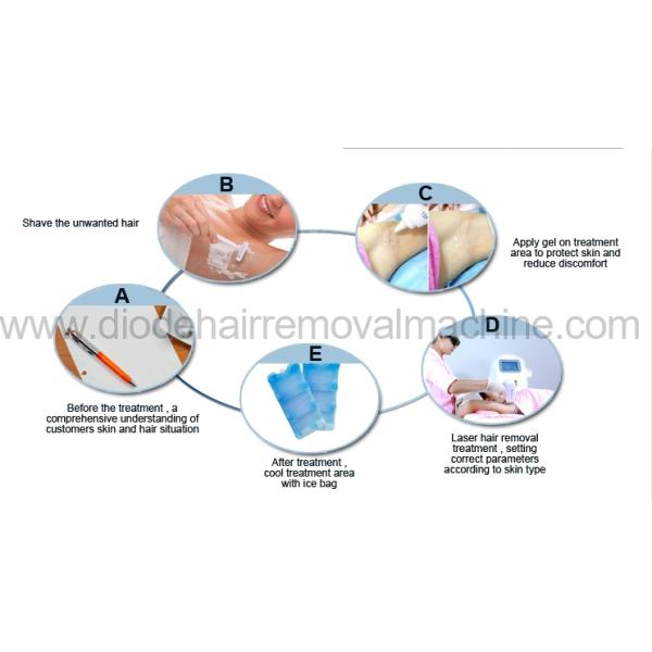 Stable Output 808 Laser Hair Removal Device Beauty Salon Equipment ISO13485