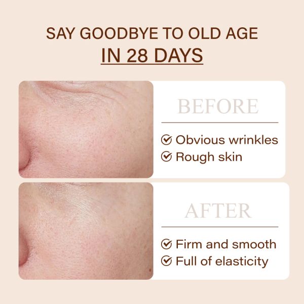 Private Label Proxylane Facial Cream Wrinkles Remover Firming Moisturizer Brightening Skincare Anti Wrinkle Age Aging Face Cream