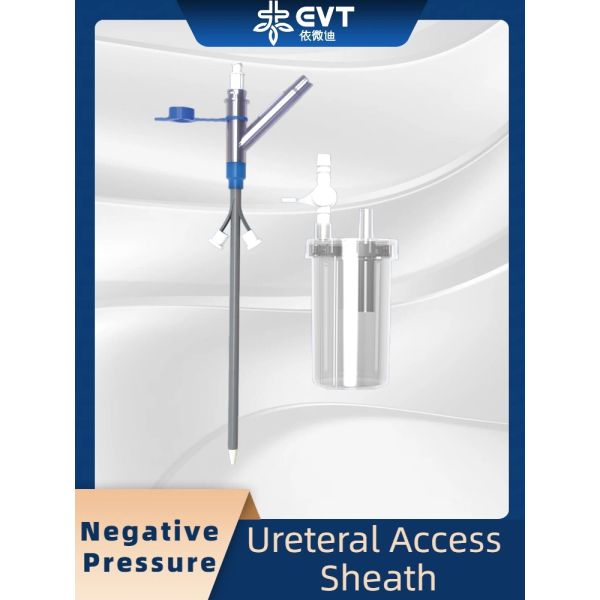 Kit de nefrostomía percutánea (Protección visceral) – Catéter de seguridad Pigtail incluido