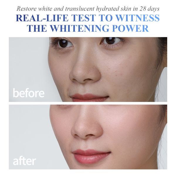 Manufacturer's Luxury Anti-Aging Facial for Essence Anti-Wrinkle Moisturizing Whitening Serum for Premium Home Use Skin Care
