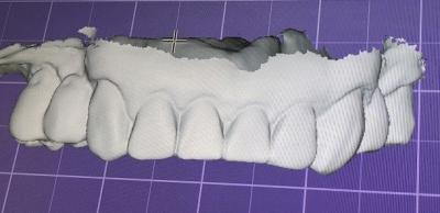 3D Digital Mock Up Teeth Other Dental Products