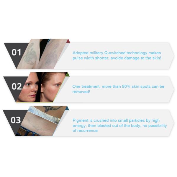 Most professional laser tattoo removal machine beauty equipment q switched nd yag laser