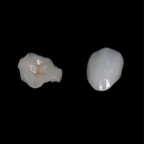 Cera Estética Dental Vidrio Cerámica Vidrio Coronas Cerámicas Consumables dentales