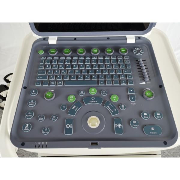 Hospital Outside 2020 New Portable Digital 15 Inch Color Doppler Ultrasound Machine