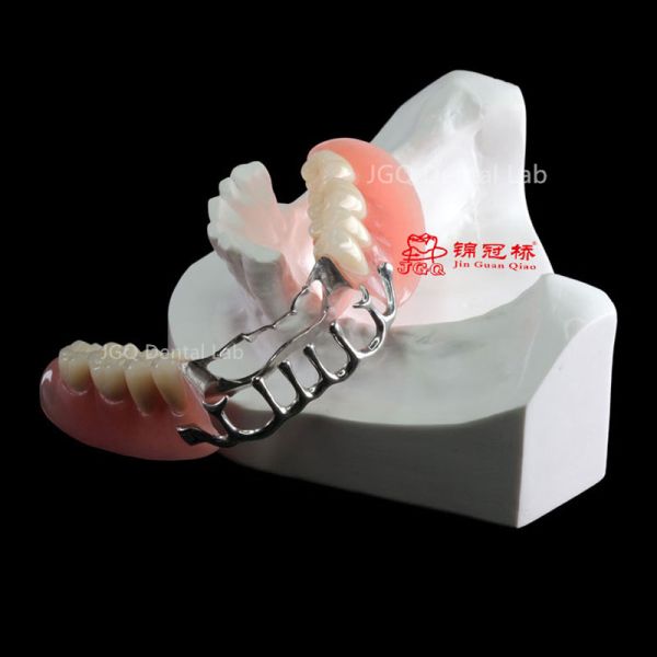 3D Laser Printing Removable Dentures Customized with Co-Cr Alloy Framework