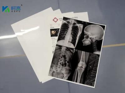 13X17'' White 180 Microns PET X Ray Film Sheets Transparency Film For Inkjet Printers