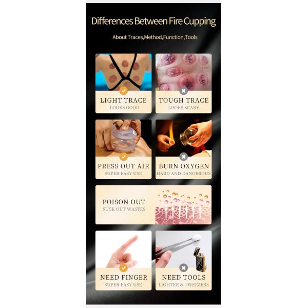 Терапия массажа фитнеса здоровья китайской медицины Ce резиновая придавая форму чашки