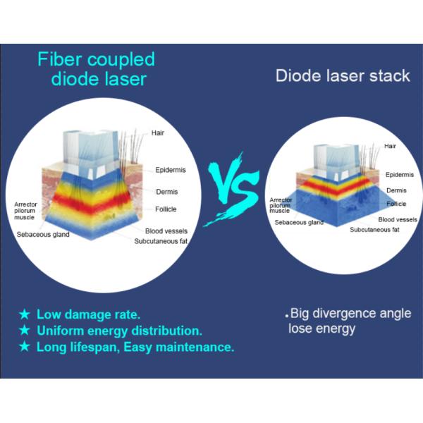 Длина волны машины лазера волокна лазера удаления волос Trible