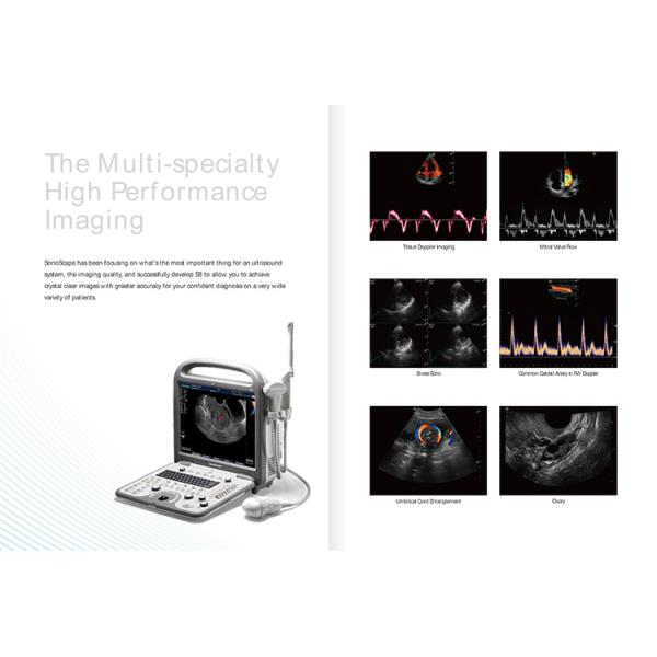 Sonoscape S8 B/ 2B/ 4B/ M/CW Echocardiography Ecograph 4D Laptop Notebook Portable Color Doppler